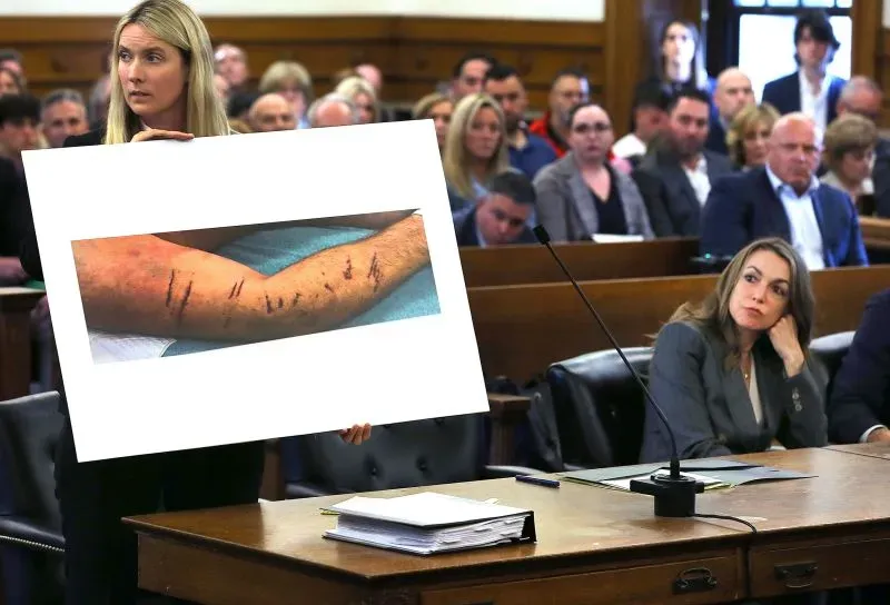 امرأة تعرض صورة لذراع مصاب بأضرار أثناء محاكمة كارين ريد، وسط جمهور في قاعة المحكمة، حيث تتعلق القضية بوفاة ضابط شرطة بوسطن.