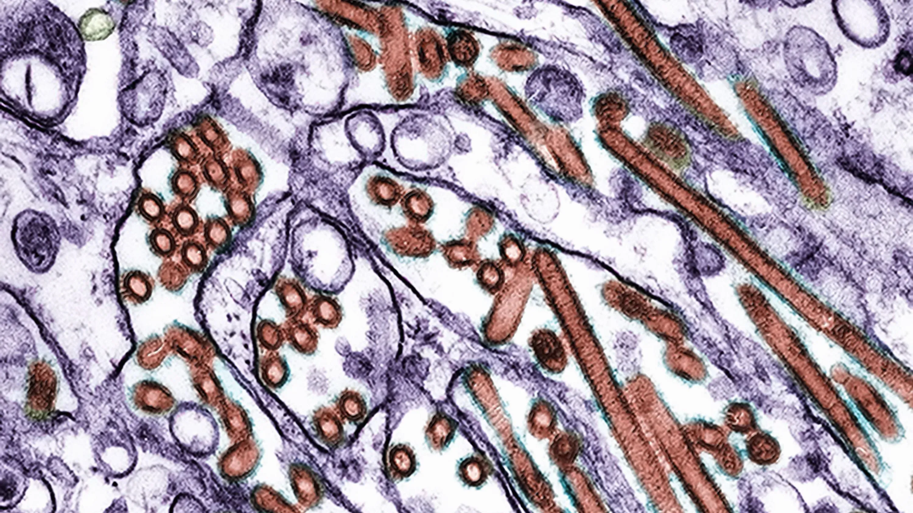 صورة مجهرية توضح فيروس إنفلونزا الطيور H5N1، الذي تم تحديده في حالة طفل في سان فرانسيسكو، مع التركيز على التركيب الفيروسي.