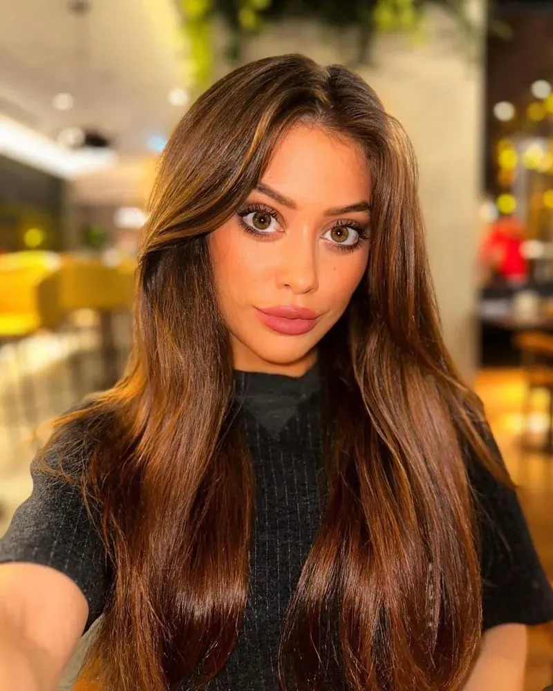 صورة لكيم هابرلي، التي تظهر شعرها الأشقر الداكن وعينيها اللوزيتين، مع تفاصيل عن الشقوق الجراحية من عملية شد الوجه.