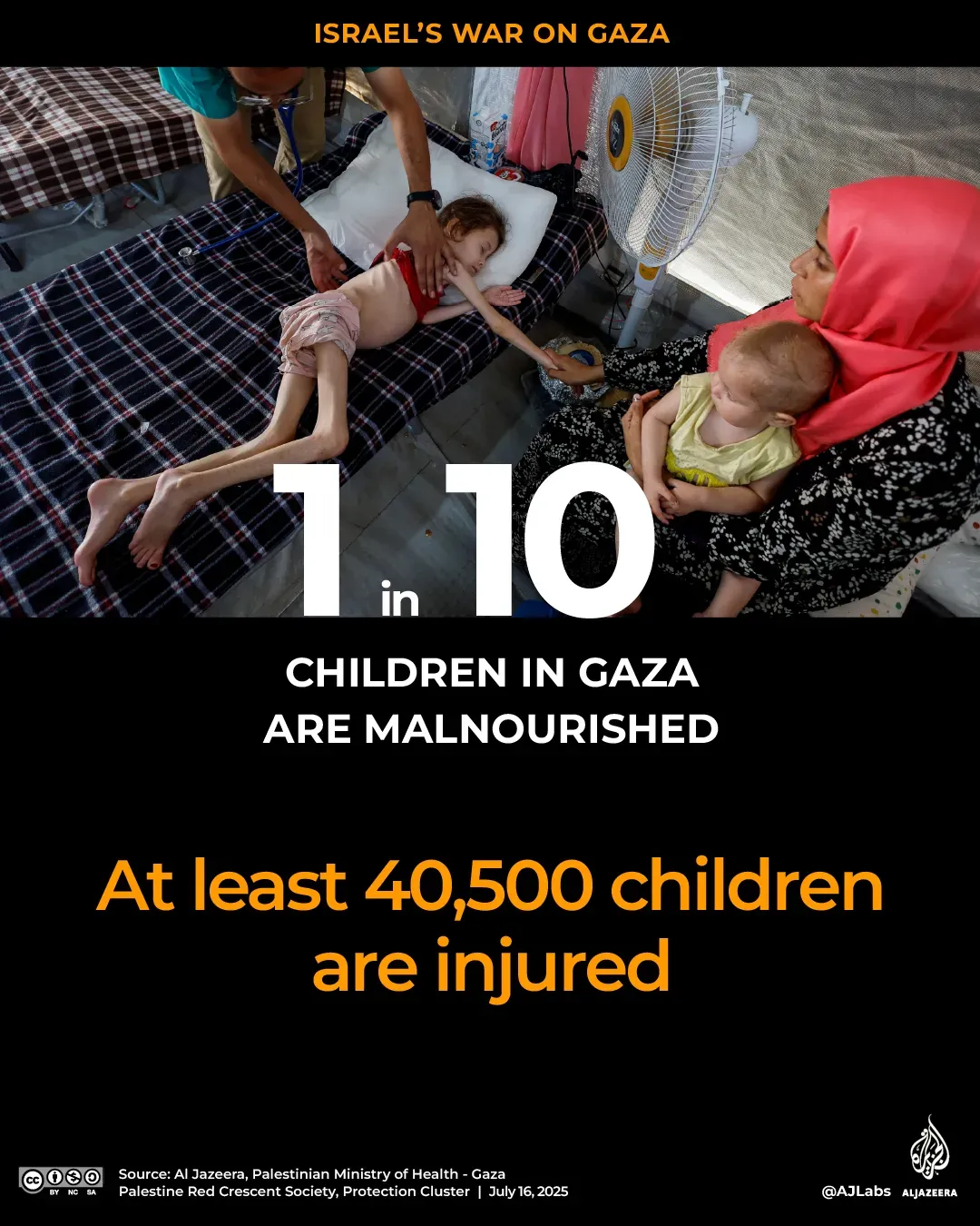 طفل نحيف يعاني من سوء التغذية في عيادة بغزة، مع وجود طفل آخر بجانبه وأم تراقب الوضع. تشير الإحصائيات إلى أن واحدًا من كل 10 أطفال في غزة يعاني من سوء التغذية.