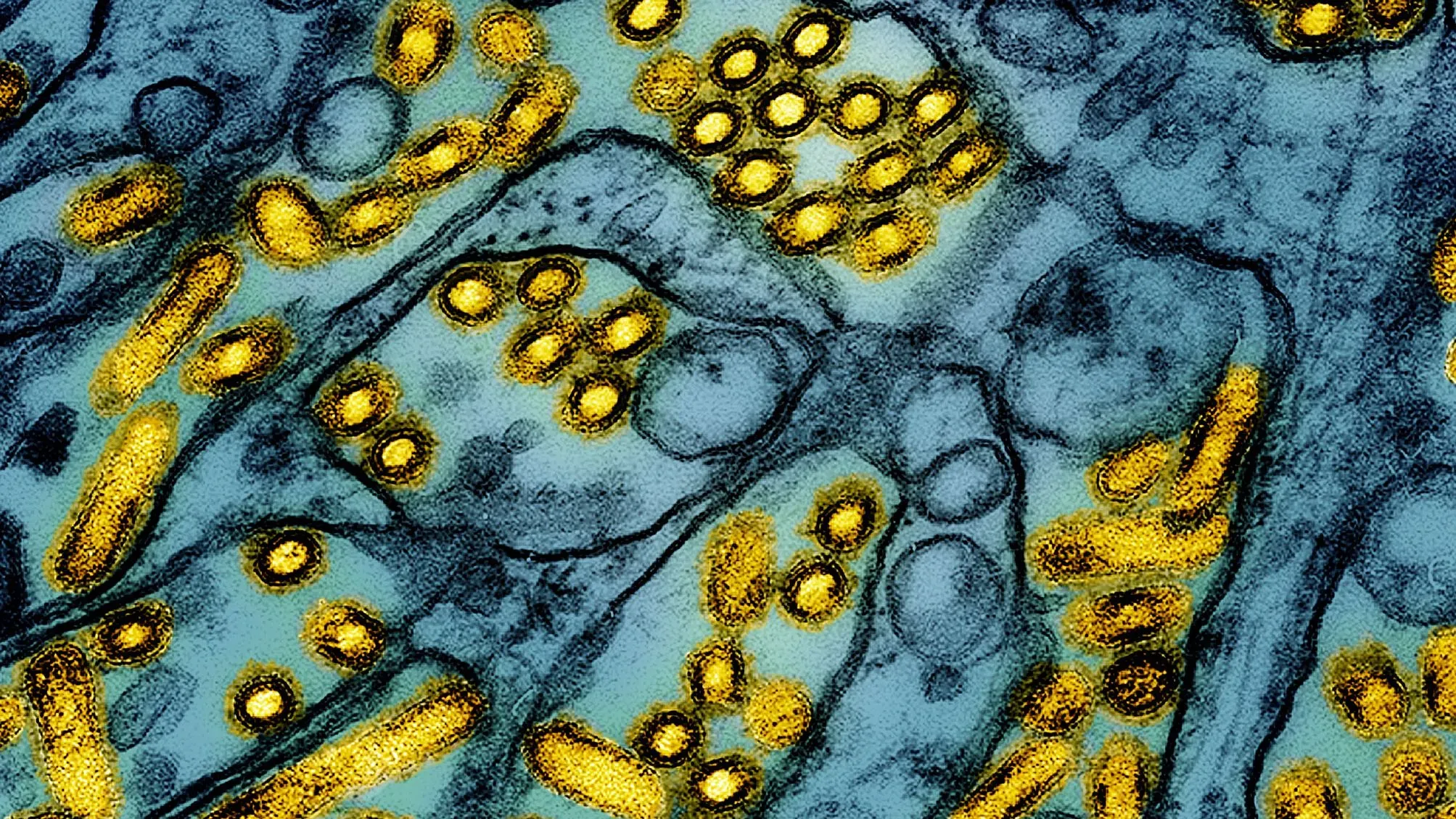 صورة مجهرية توضح فيروس إنفلونزا الطيور H5N1، يظهر بشكل كروي وبيضاوي باللونين الذهبي والأزرق، مما يعكس خطورته على الطيور والبشر.