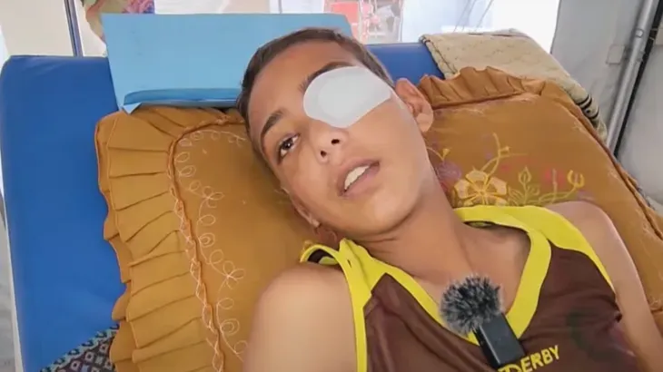 طفل فلسطيني مصاب برصاصة في عينه اليسرى، مستلقيًا على سرير في المستشفى، مع ضمادة على عينه، يعبر عن أمله في استعادة بصره.