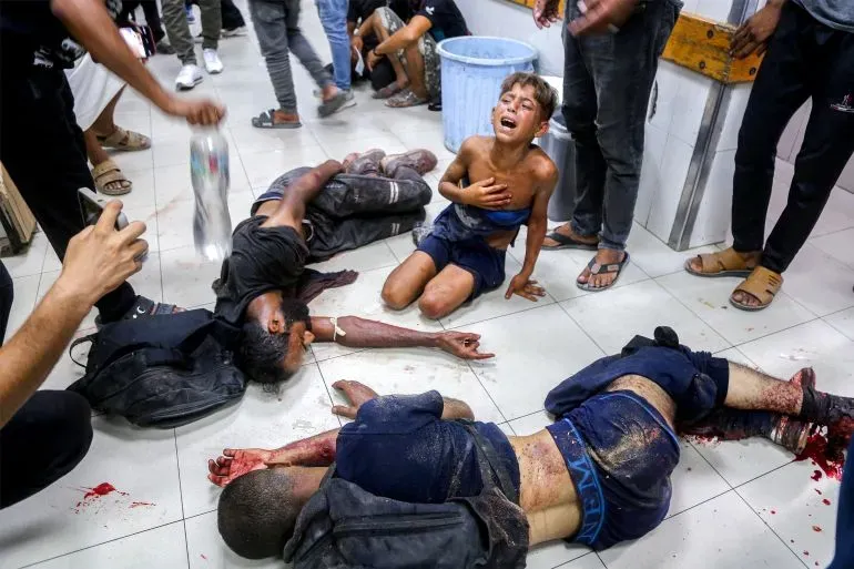 أطفال مصابون في مستشفى بغزة، يظهر أحدهم يبكي بينما يرقد آخرون مصابين بجروح خطيرة، في ظل الأوضاع الإنسانية القاسية.