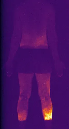 صورة حرارية تظهر جسم رجل من الخلف مع تسليط الضوء على المناطق الساخنة، مما يعكس تأثير التعرض للحرارة خلال مكافحة حرائق الغابات.