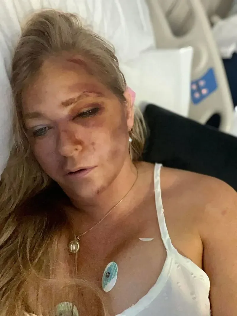 فيرجينيا جيوفري مستلقية على سرير المستشفى، تظهر عليها الكدمات بعد حادث سير، حيث زعمت أنها تعرضت لصدم من حافلة مدرسية.